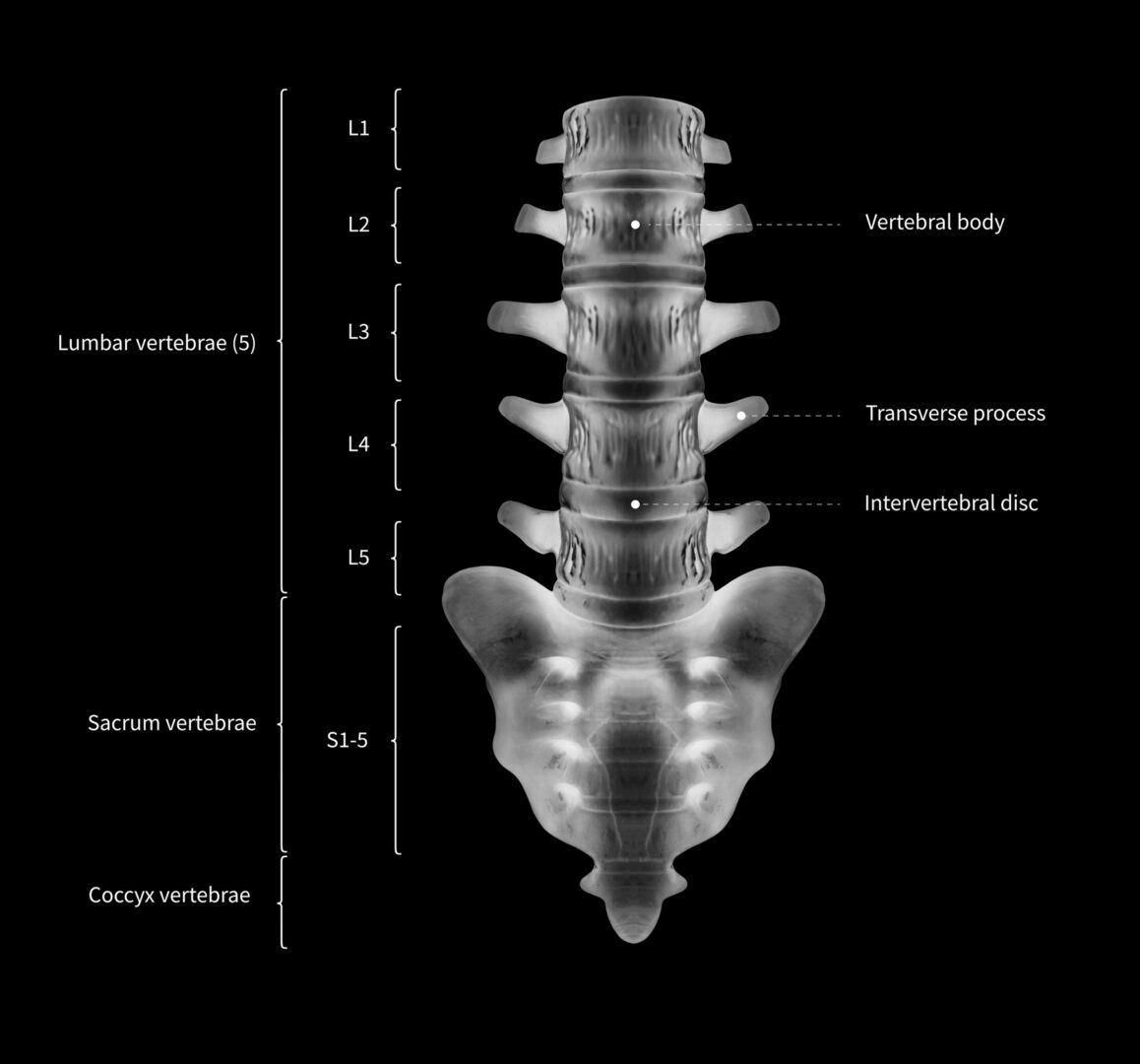 Infographic diagram of human lumbar vertebrae with sacrum or spine bone anatomy system anterior view-3D- human anatomy- medical diagram- educational and human body concept- black and white x-ray color